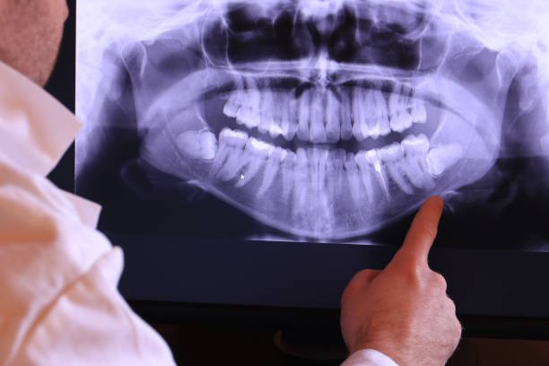Best Pediatric Emergency Dentist in Wellston, OH